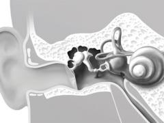 Was ist Tinnitus und was