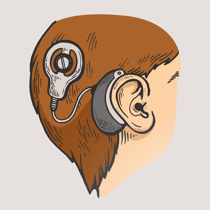 Cochlea-Implantat
