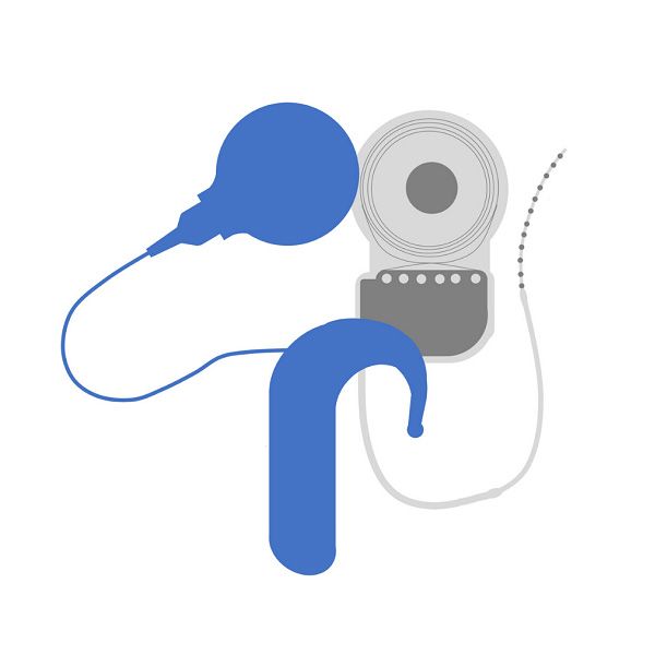 Cochlear-Implant