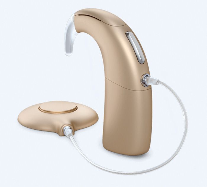 Cochlear Implantat