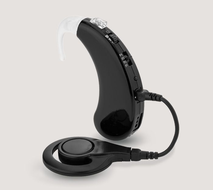 Cochlear Implantate