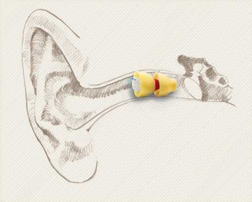 Phonak Lyric