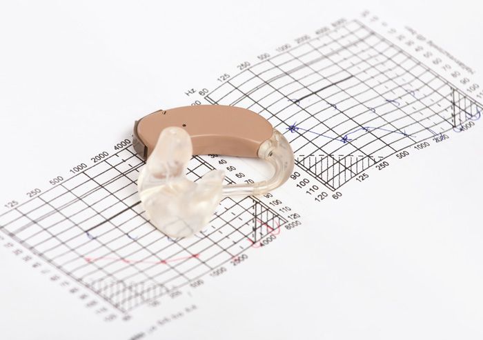 Audiogram Hörgeräteakustiker