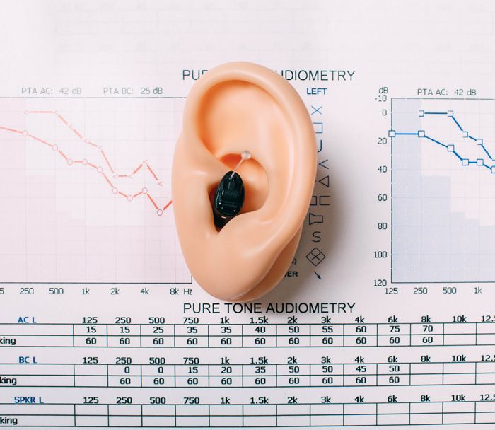 Anpassung beim Hörgeräteakustiker