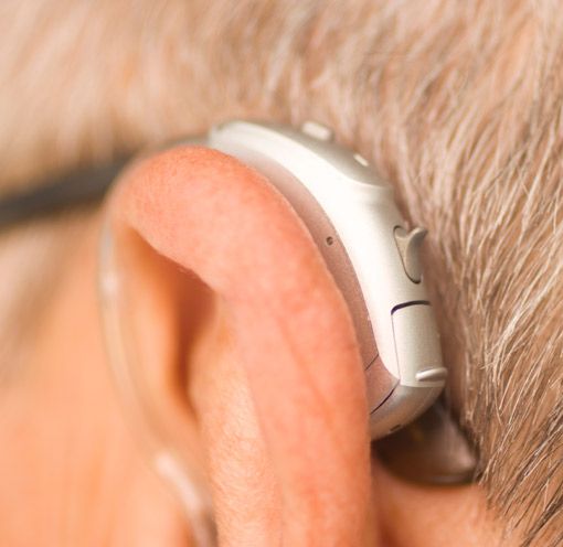 Hinter dem Ohr Hörgerät