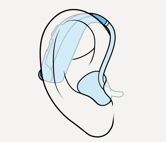 Hinter-dem-Ohr Hörgerät