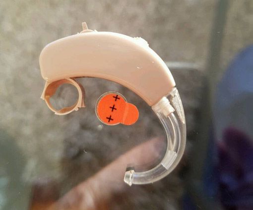 Gebrauchte Hörgeräte Bei Ebay Kaufen Worauf Muss Man Beim