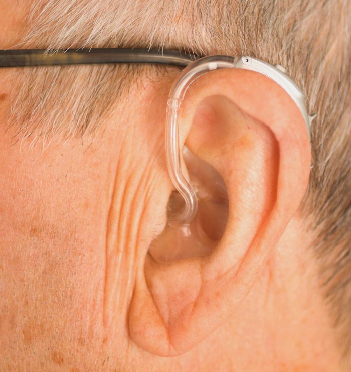 Otosklerose Symptome Diagnostik Und Behandlung Der Mittelohr Krankheit