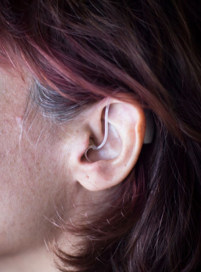 Schwerhörige Frau mit Hörgerät