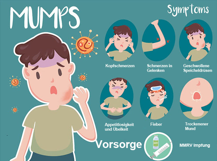 Mumps Symptome