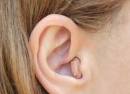 Im-Ohr Hörgeräte: Preise, Kosten und 